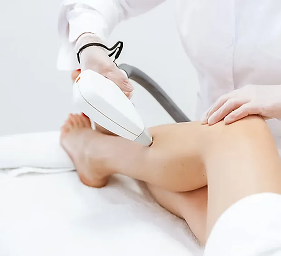 Laser hair removal